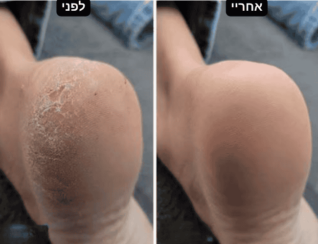 ערכת חידוש העור של SHIROKA